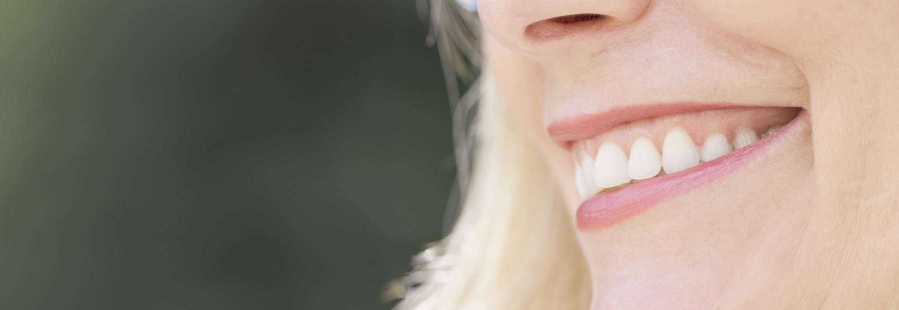 Close up of person's smile with thin lips.