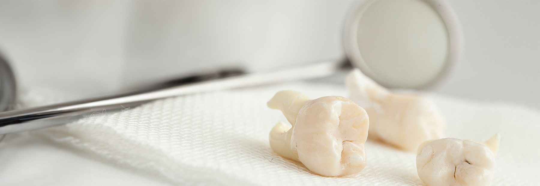 Cleaned, adult teeth lying on dental tray post-extraction.