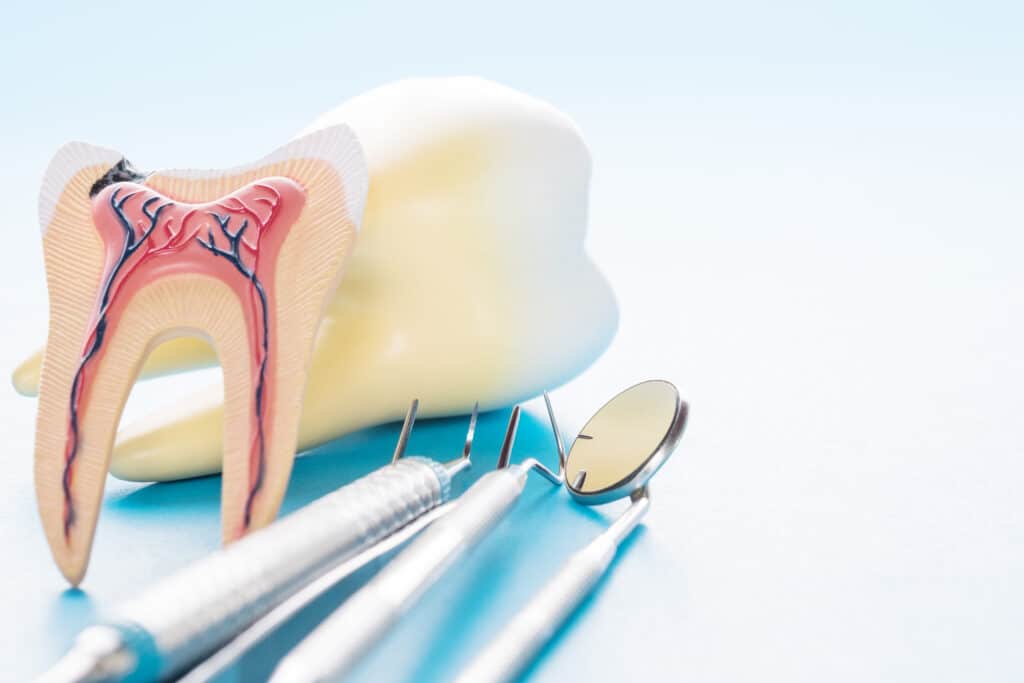 Anatomy of the inside of a tooth next to dental tools.