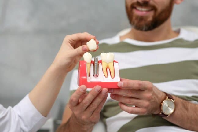 Patient holding dental tooth model as doctor holds tooth to reveal post for dental implant.